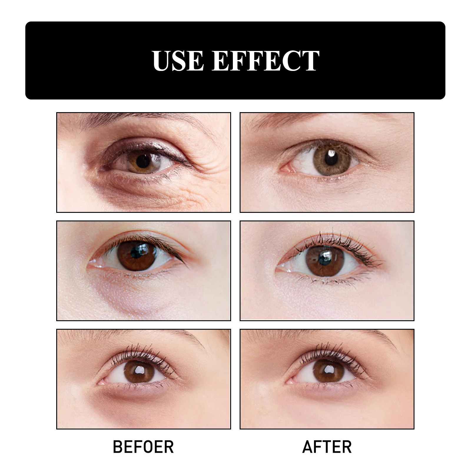 מיידי קמטים קרם עיניים אנטי להסיר את שקיות עיניים אנטי-אייג ' ינג, קרם לחות מוצרים Nicotinamide לדעוך קמטוטים להאיר טיפול יופי