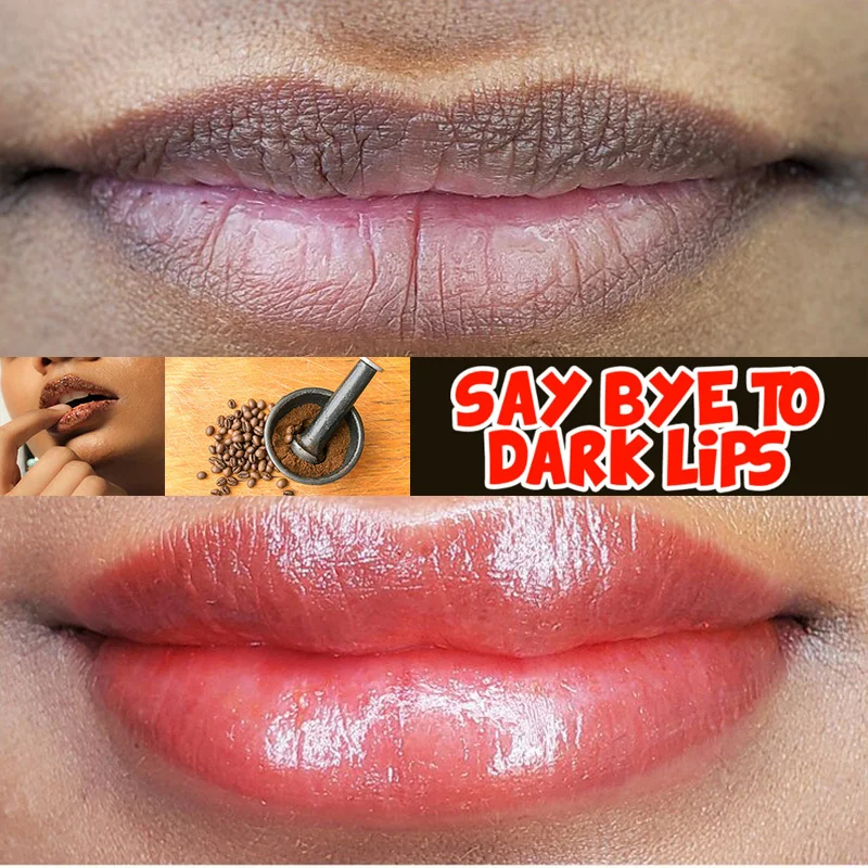 10Pcs שפתיים ורוד סרום טרי להסיר כהה השפתיים ג ' ל בסדר תיקון קו להאיר השפה אקספוליאטור להלבין קרם לחות מזין המהות.