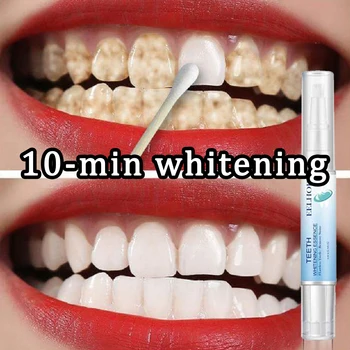 10 דקות מהר הלבנת שיניים המהות להסיר רובד כתמי היגיינת הפה הלבנת ניקוי נשימה טרי רפואת שיניים אכפת לי כלים